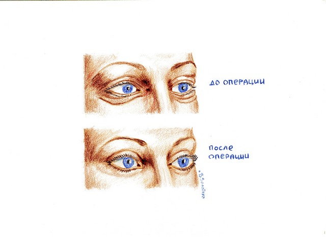 РЕЗУЛЬТАТ ОПЕРАЦИИ РЕЗУЛЬТАТ ОПЕРАЦИИ